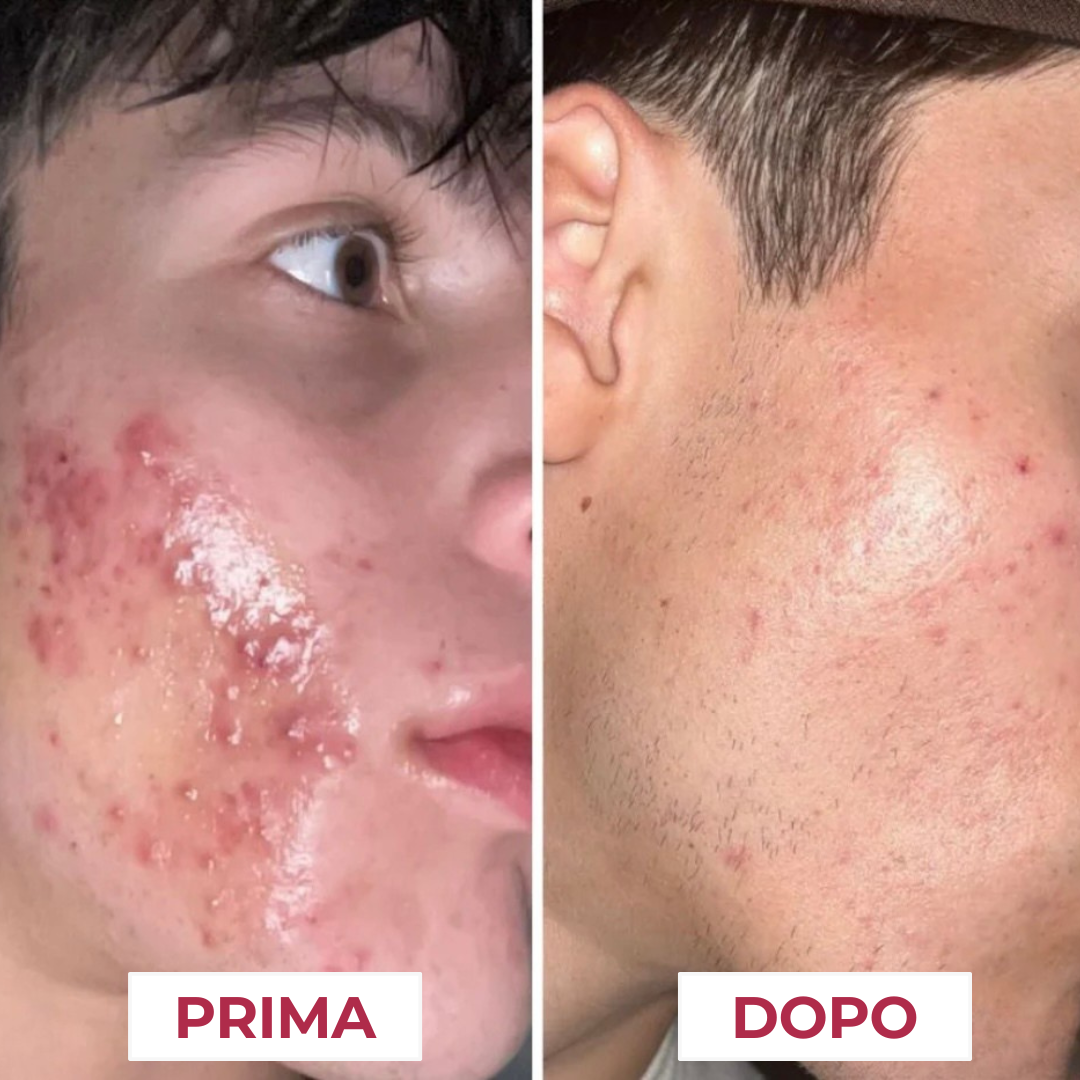 Crema al collagene coreano | Pelle Pulita in 7 giorni