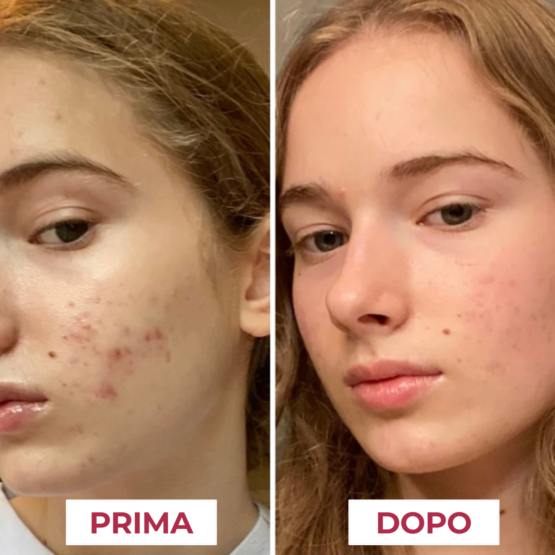 Crema al collagene coreano | Pelle Pulita in 7 giorni